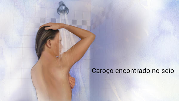 Câncer de mama